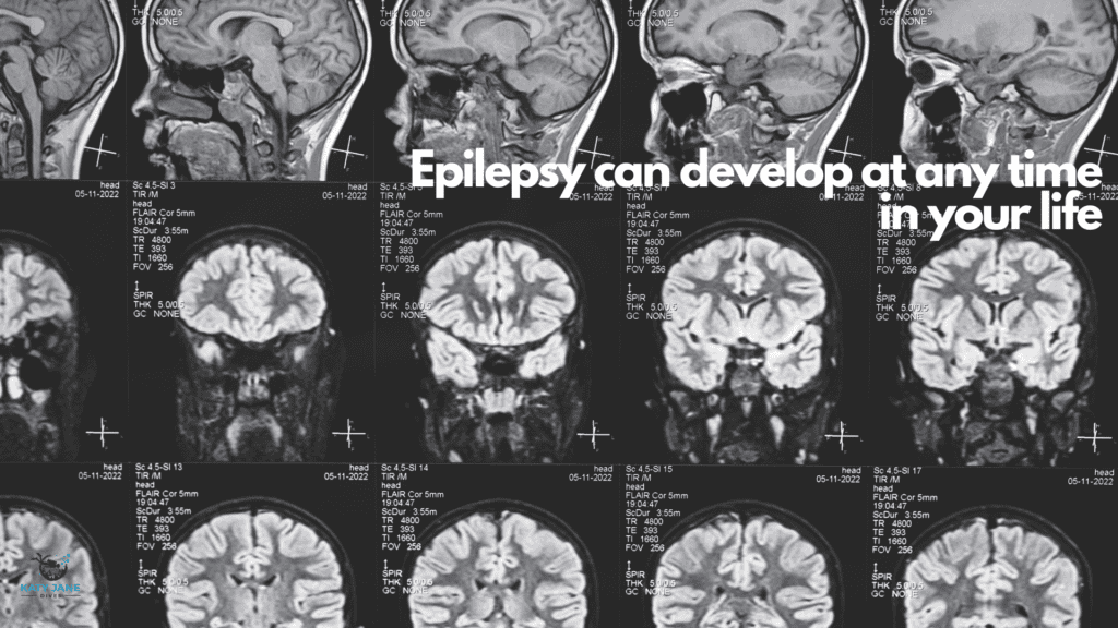 images of brain scan